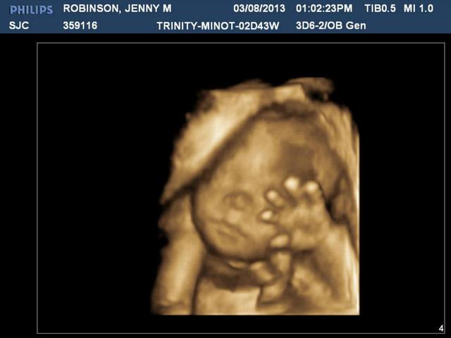 Found out we were Pregnant!