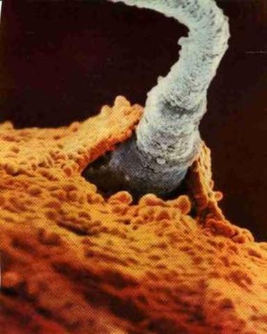 Fertilization