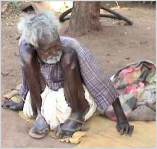 Disease in Period One