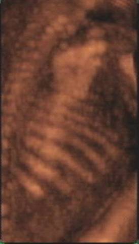 Ribs begin to develop