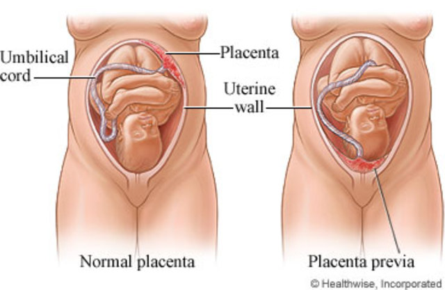 Placenta forms
