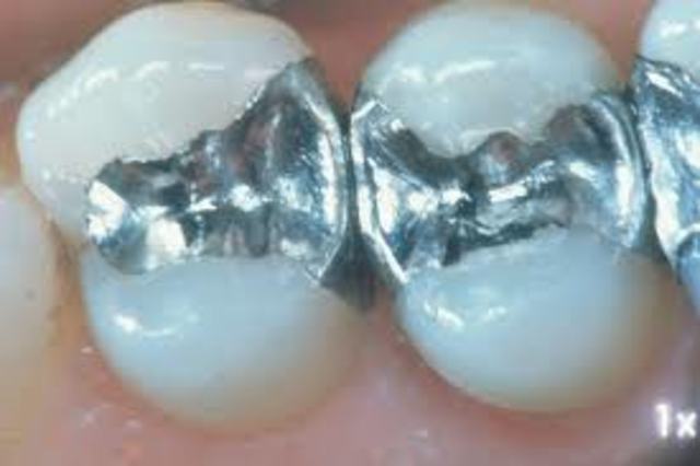 Biomaterial: Amalgama