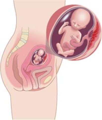 Week 14 of development