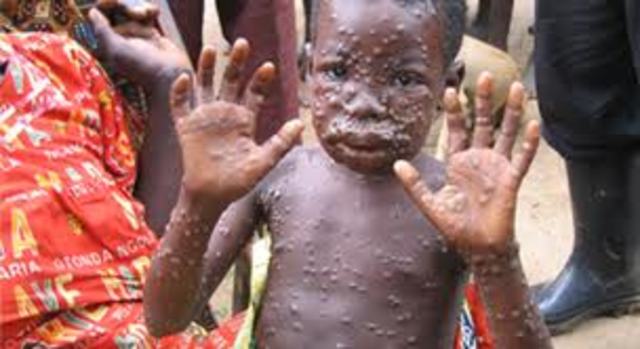 Monkeypox is confirmed in humans for first time in Western Hemisphere with four cases in Wisconsin.
