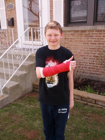 I broke my wrist !!!