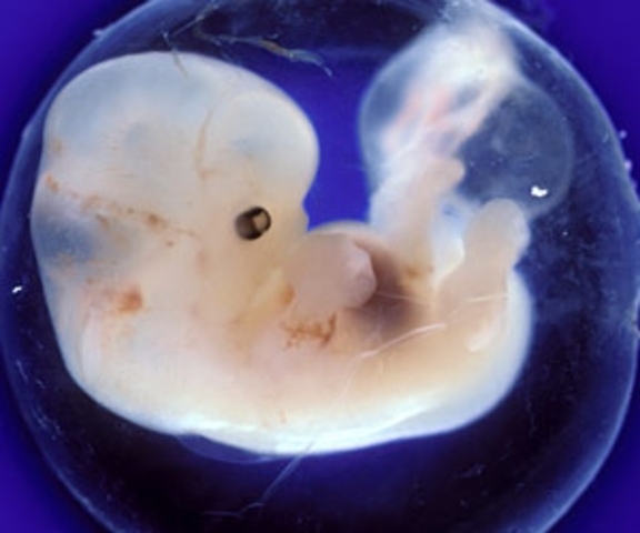 Is that another heart?