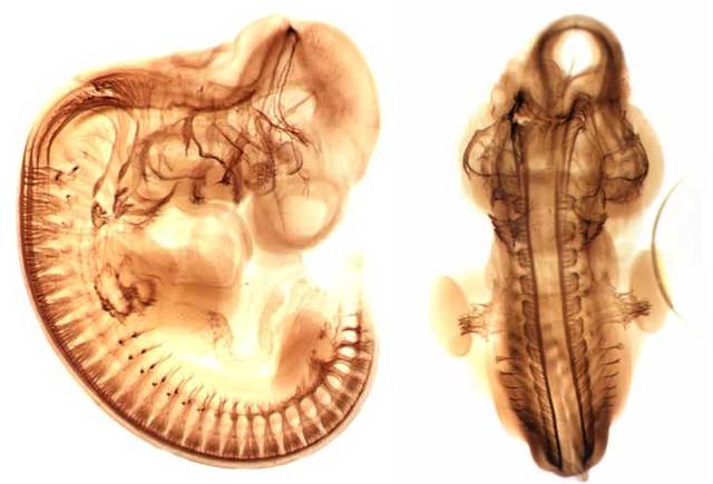 Organ development continued