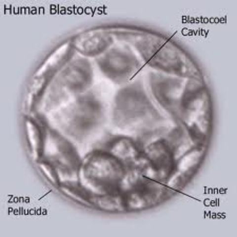 Morula changes into blastocyct