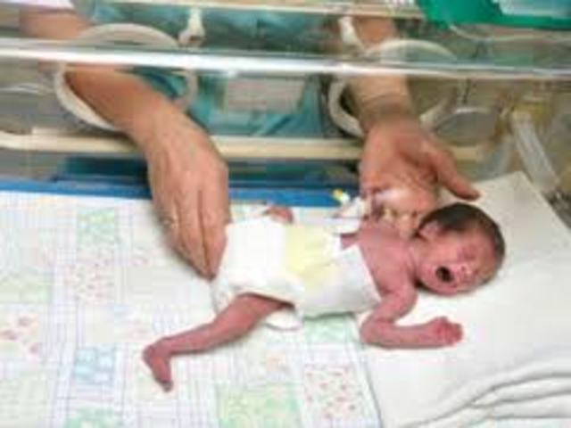 Premature Labor