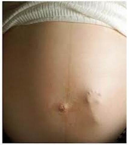 Baby starts major reflexes