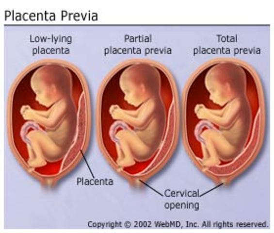 Placenta Forms
