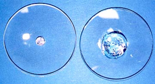 Hidrogeles: Biomaterial.