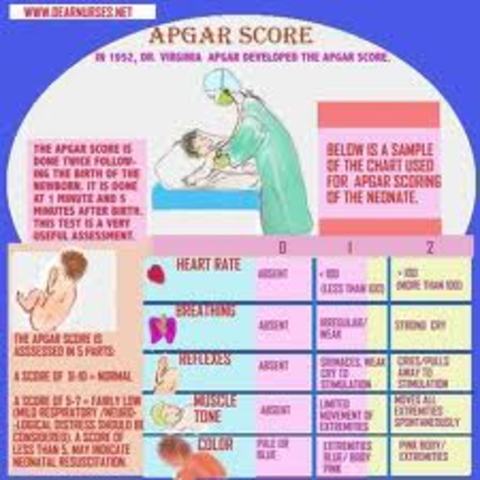 Apgar score for babies