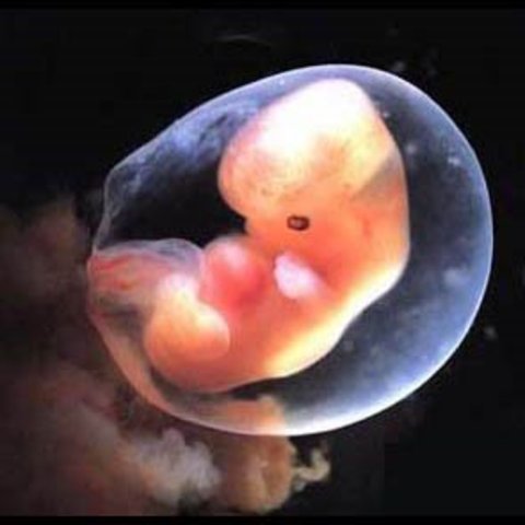 Arm and Leg Buds Form