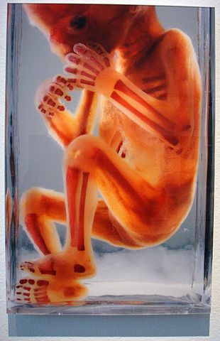 Bones Are Developing