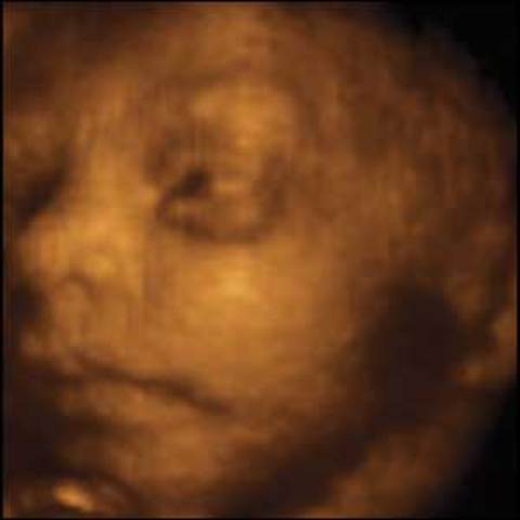 Eyes Can Sometimes Open, Skin is Coated in Vernix