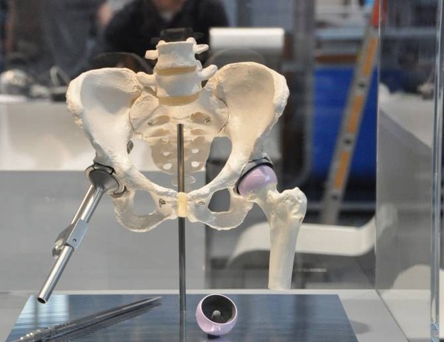 Prótesis de cadera