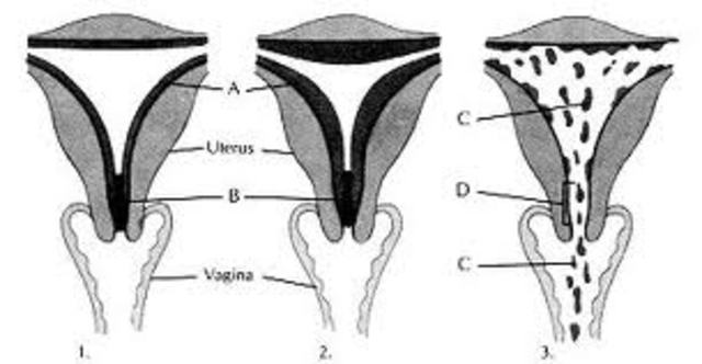 Last day of menstral cycle/ Start of first trimester