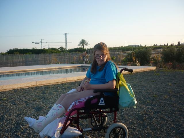 ME OPERE LAS PIERNAS