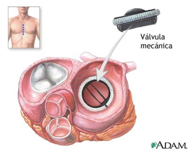Valvulas Cardiacas - De células madres