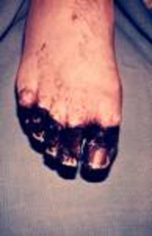 Plague closes theaters