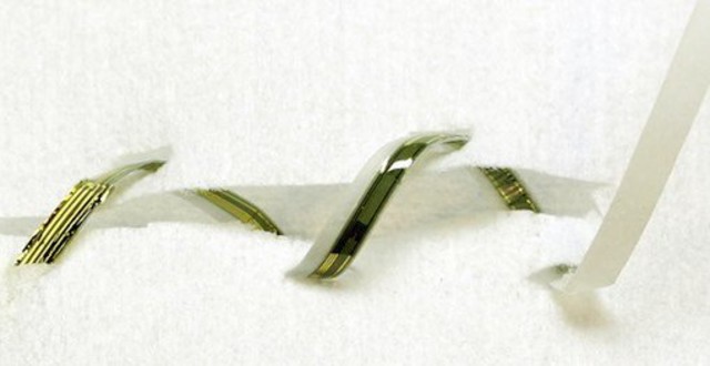 Suturas "inteligentes"