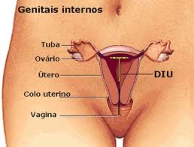 DISPOSITIVO INTRAUTERINO (biomaterial)