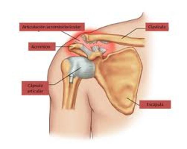 Ligamentos artificiales