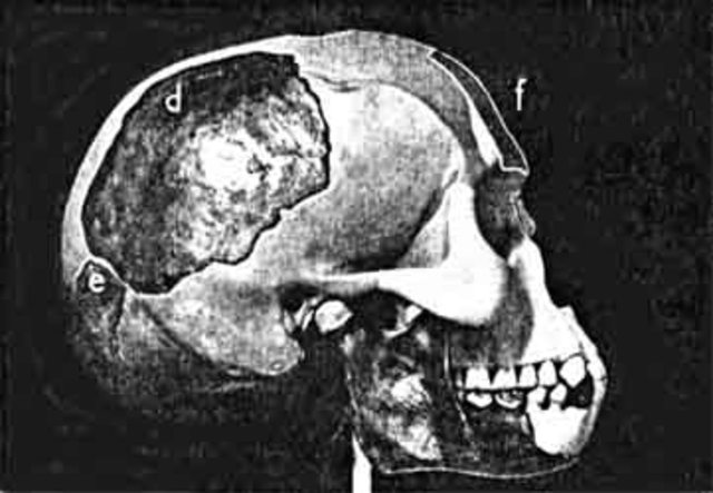 Piltdown Man