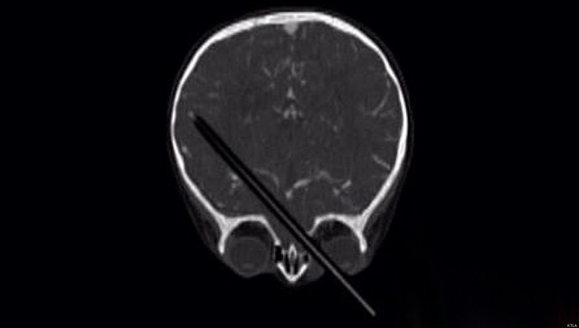 13-15 Months (Cognitive Development)