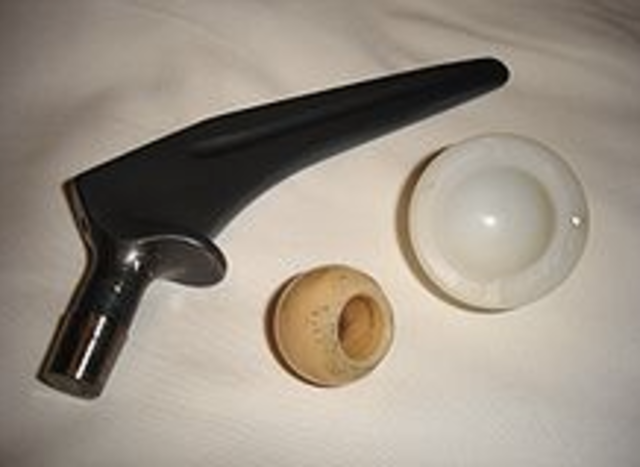 TITANIO  - COMO BIOMATERIAL