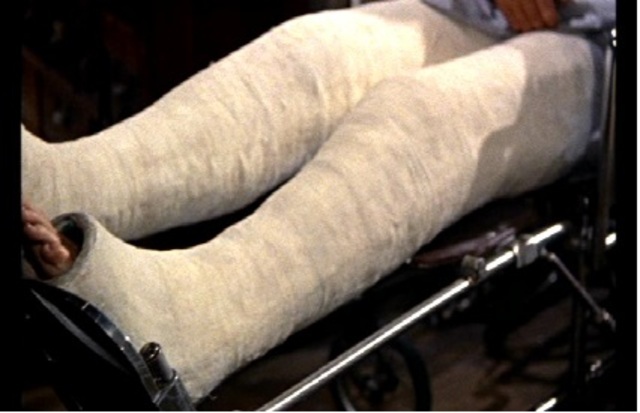 Torn ACL e MNL, joelho quebrado por segunda vez