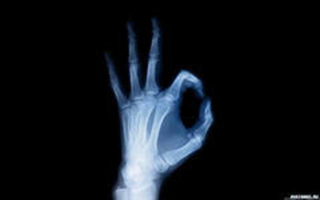 Открытие  рентгеновского излучения