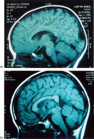 19-21 Months (Cognitive Development)