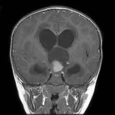 22-24 Months (Cognitive Development)