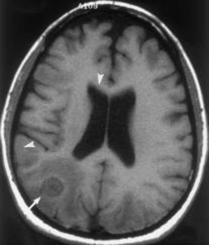30-36 Months (Cognitive Development)