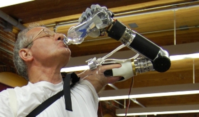 Advanced Prosthetics