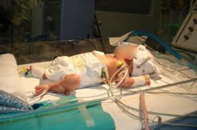 fui hospitalizado por que naci con una infexion