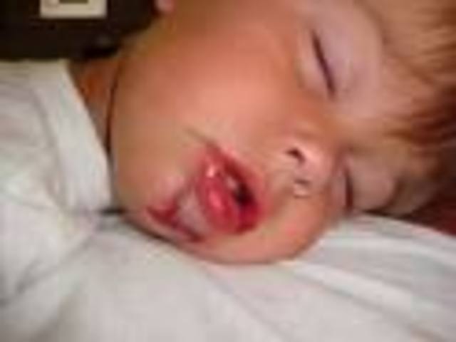 cracked my chin open