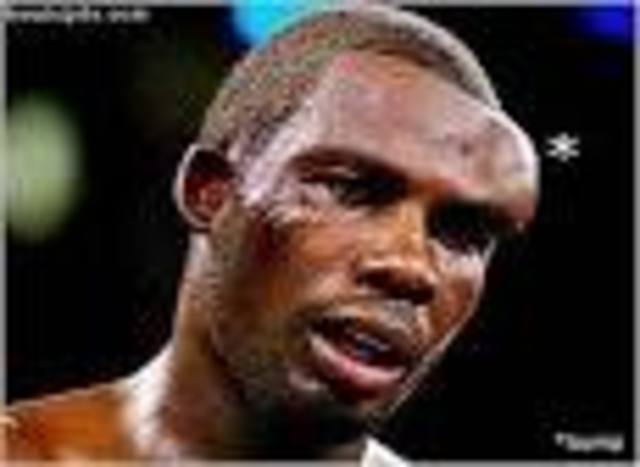 cracked my head open