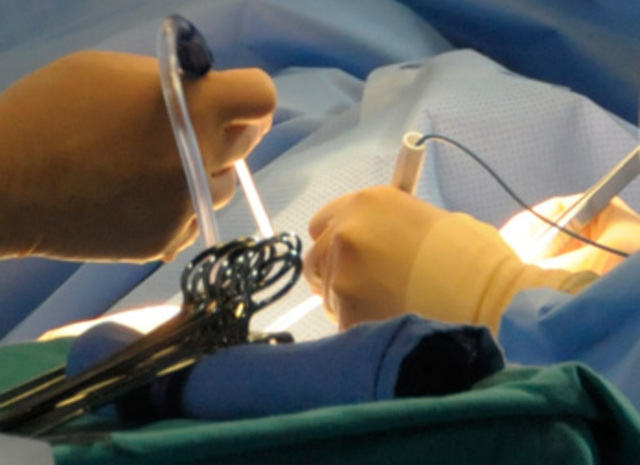 First organ transplant