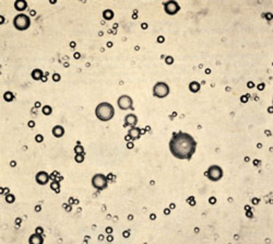 Microspheres and coacervates (Sidney Fox)