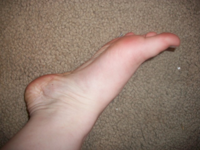 i became a chiropracter. :)