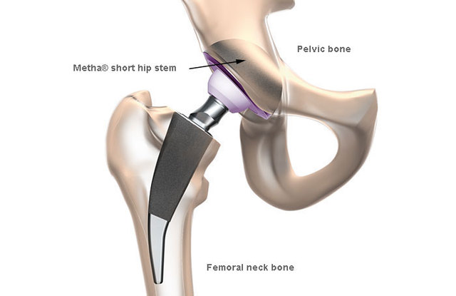 Parents life changed.