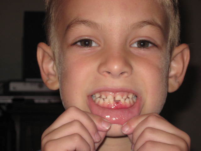 Lost my 1st tooth