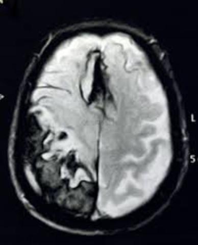 4.AP (ANTECEDENTES PERSONALES)