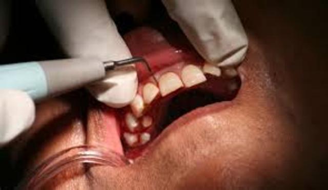 Curt Lemon gets tooth pulled by the dentist