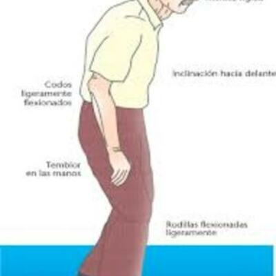 Timeline: MOTIVO DE CONSULTA