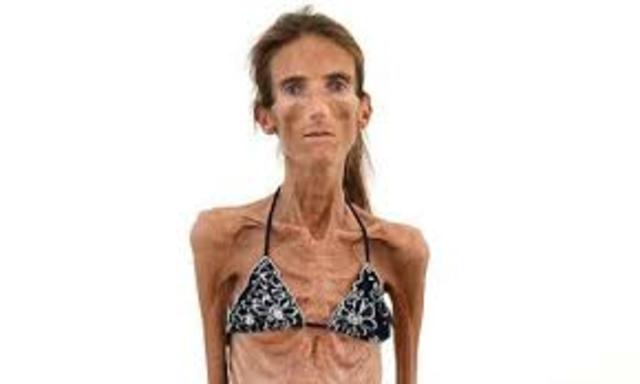 PRINCIPIO Y EVOLUCIÓN DEL PADECIMIENTO ACTUAL