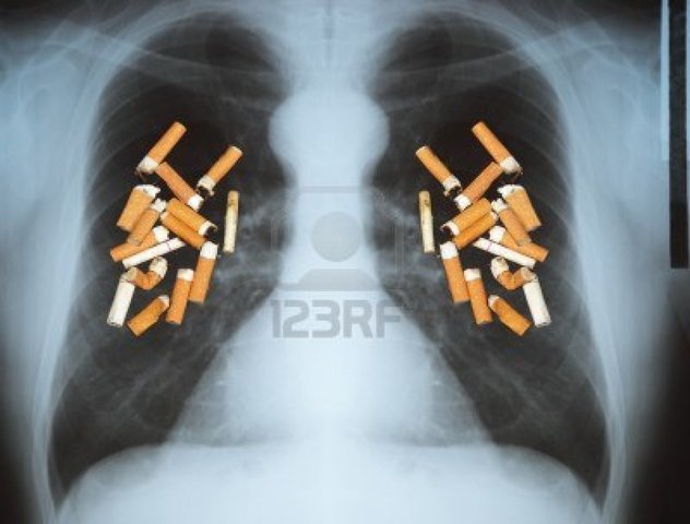 Cigarette smoking is reported to cause lung cancer